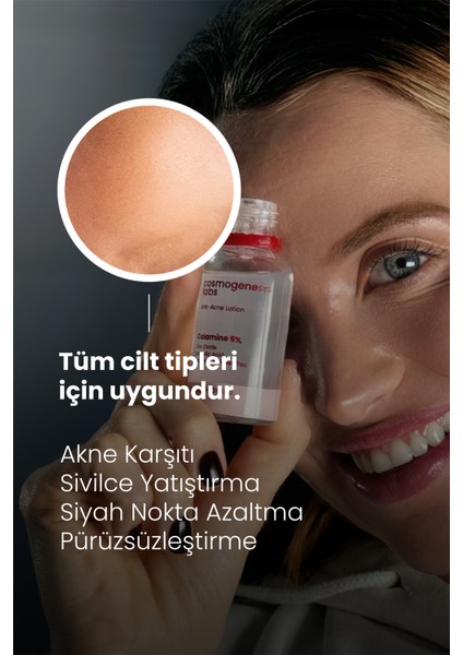 Akne Karşıtı Losyon 30ml – Akne Yatıştırıcı, Siyah Nokta Azaltıcı Vegan (%5 Calamine – Yeşil Çay) indirimleri