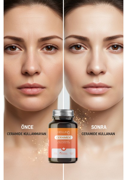 Ceramide 60 Kapsül – Cilt Bariyerini Güçlendiren %100 Vegan Takviye - Phytoceramide 60 mg, ALA, B6, B12