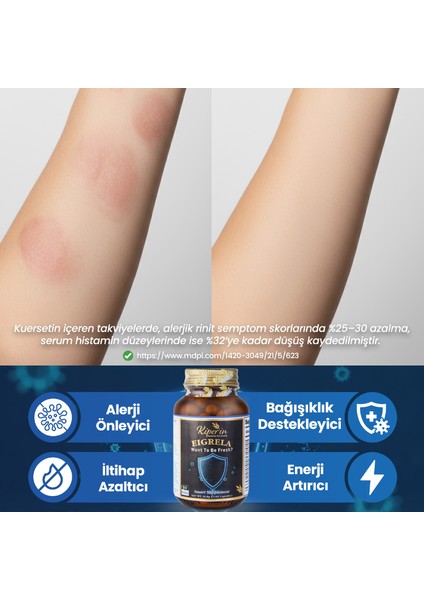 Eigrela | Alerji | Kuersetin, Kekik, Astragalus, Çörek Otu, Akgünlük.. | 60 Kapsül fiyatları