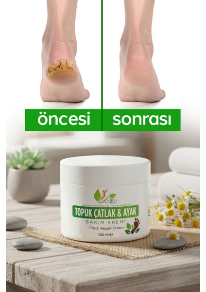 Ayak ve Topuk Çatlak Bakım Kremi 100 ml modelleri