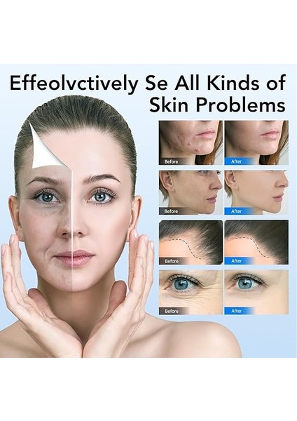 A6 Microneedling Kalem Yüz ve Vücut Için Mirco Iğneleme Derma Kalemi Yara Serumu Için 5 Hız Derinliği Ayarlanabilir 2 Yedek Pil ve 10 Kartuşla 36-Pin Kablolu ve Kablosuz Ingiltere Tak fiyatları