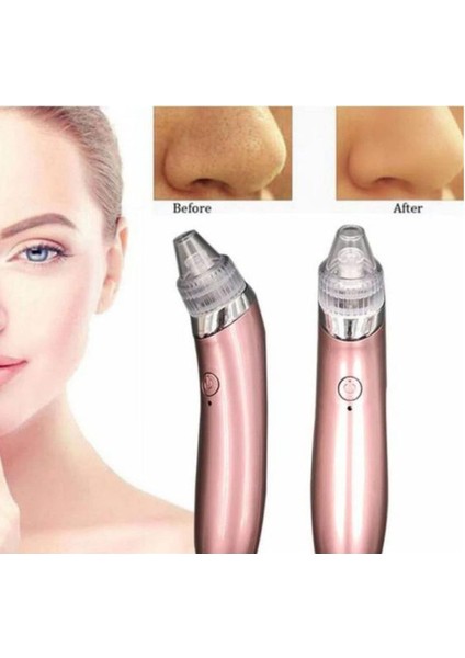 Mobee Profesyonel Vakumlu Siyah Nokta Akne Cilt Temizleme Cihazı