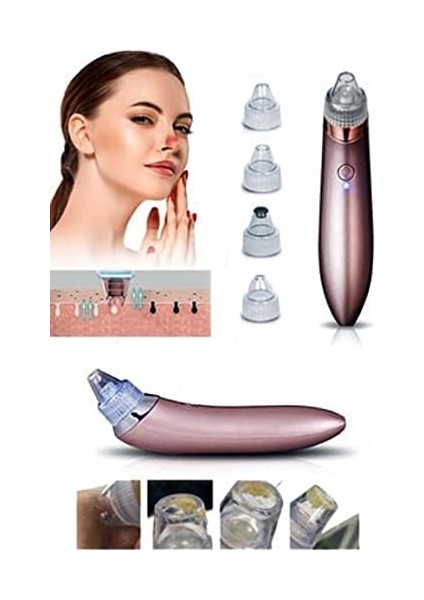 Mobee Vakumlu Akne Siyah Nokta Leke Çıkarıcı Cilt Temizleme 4 Başlıklı fiyatları