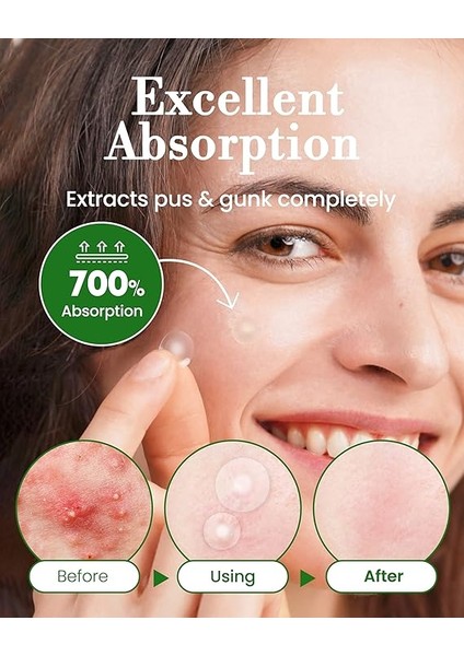 Ultra Ince ve Şeffaf Suya DAYANIKLI%700 Emme Kapasiteli Kore Üretimi Akne ve Sivilce Bandı 96'lı indirimleri