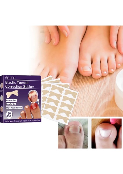 Buğz Ayak Tırnağı Düzeltme Bandı 50 Adet