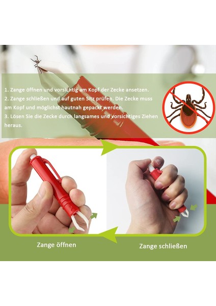 Köpekler, Kediler, Çocuklar, 3 Set, Kene Kancaları ve 2 Set, Kene Cımbızları, Kolay ve Güvenli Kene Çıkarıcı (Yurt Dışından) fiyatları