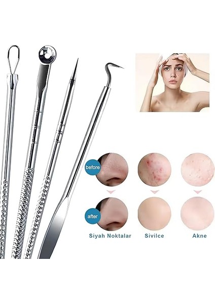 4'lü Siyah Nokta & Akne Temizleme Seti – Paslanmaz Komedon Iğneleri, Sivilce Giderici Cilt Temizleme Araçları indirimleri