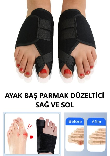 Ayak Baş Parmak Düzeltici Kemik Çıkıntısı Düzeltici Halluks Gece Ateli modelleri