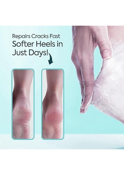 Topuk Çatlağı Kremi – Kuru ve Çatlamış Topuklar Için – E Vitamini ve Avokado Yağlı Topuk Kremi – Nasır, Sert ve Ölü Deriler Için Nemlendirici Ayak Bakım Kremi – 100 ml fırsatları