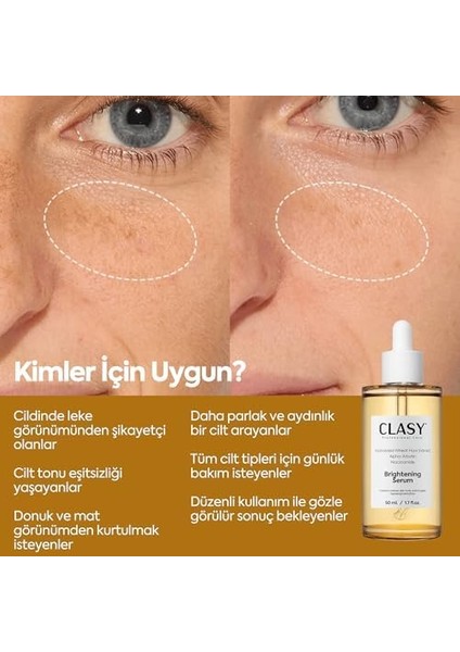Clasycare Leke Karşıtı Aydınlatıcı Yüz Serumu – Niasinamid, Alpha Arbutin ve Hyaluronik Asit Içerikli Serum – Cilt Tonu Eşitleyici, Kore Cilt Bakımı, 50ML fiyatları