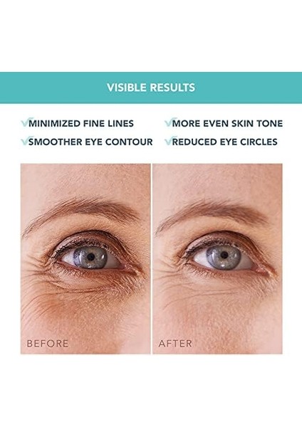 Foreo Iris Nemlendirici Hidrojel Göz Maskesi – Kadın & Erkekler Için Alt Göz Tedavisi: Koyu Halkalar & Şişkinlik Karşıtı – Nemlendirici & Serinletici – Vegan, Tüm Cilt Tipleri – 60 Adet fiyatları