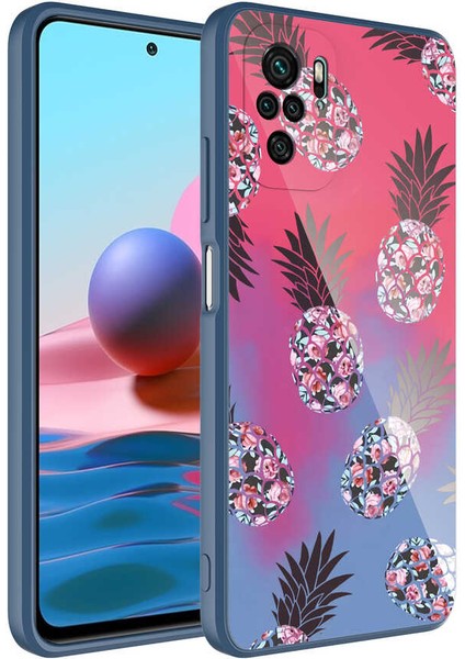 Xiaomi Redmi Note 10 Kılıf Kamera Korumalı Desenli Sert Silikon Nxxa Epoksi Kapak-No3