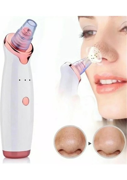 Egonex Şarjlı Siyah Nokta Temizleme Cihazı 5 Başlıklı