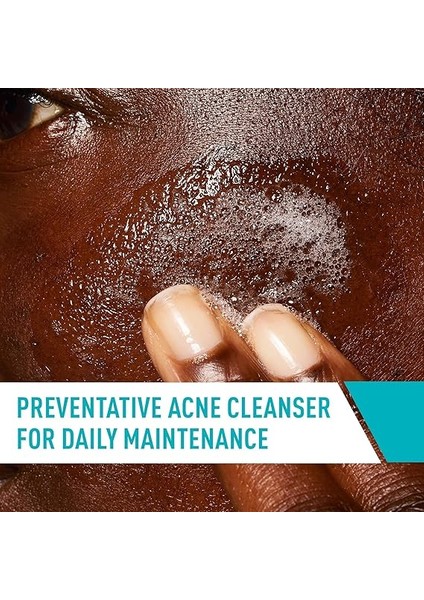Yüz Yıkama Akne Tedavisi | Yağlı Ciltler Için Arındırıcı Killi Salisilik Asit Temizleyici | Siyah Nokta Sökücü ve Tıkanmış Gözenek Kontrolü fırsatları