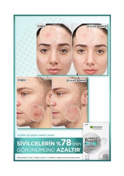 Garnıer Pimple Patch 22&apos;li Sivilce Bandı/hidrokolloid Bant modelleri