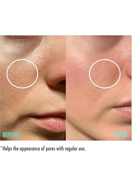 Gözenek Sıkılaştırıcı Cilt Serumu 30 ml modelleri