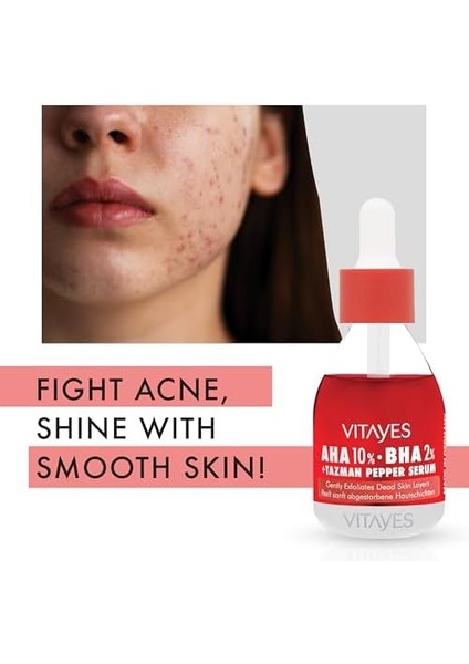 Vıtayes Aha%10 Bha%2 Kırmızı Peeling Cilt Serumu - Gözenek Sıkılaştırıcı, Cilt Canlandırıcı, Yenileyici, Ton Eşitleyici, Arındırıcı, Siyah Nokta ve Akne Karşıtı, Anti-Aging, Yaşlanma Karşıtı 30 ml