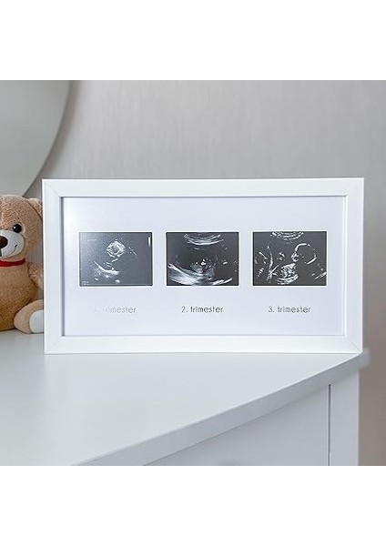 Üçlü Ultrason Anı Çerçevesi - Gebelikte Bebeğin Gelişimini Üç Trimester Anı Olarak Saklayın modelleri
