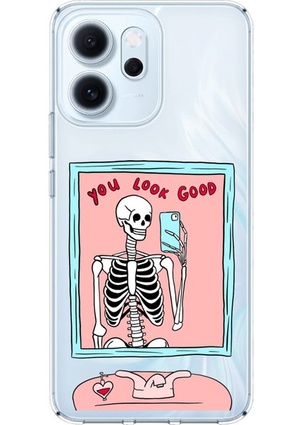 Oppo Reno 14F Uyumlu You Look Good Iskelet Tasarımlı Baskılı Silikon Kılıf