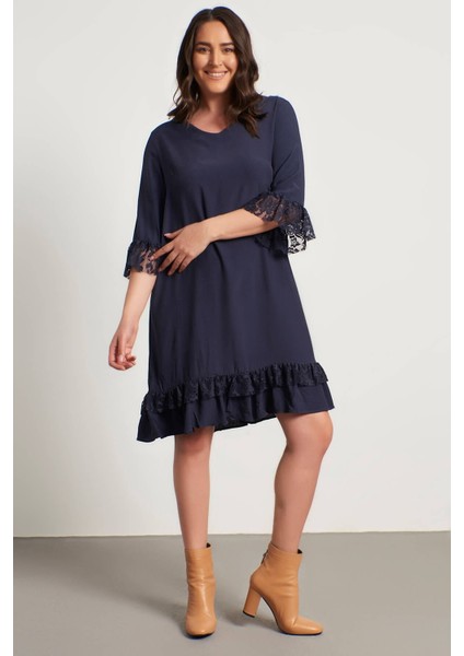 Dantel Detaylı V Yaka Elbise