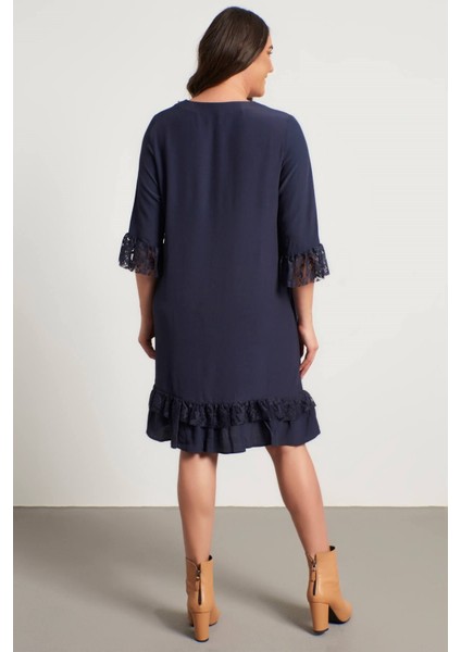 Dantel Detaylı V Yaka Elbise