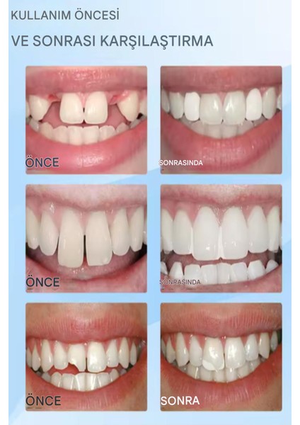 Geçici Diş Onarım Kiti – Takma Diş, Diş Dolgusu ve Kırık Diş Için Şekillendirilebilir Set modelleri