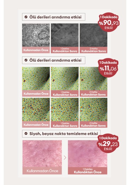 Retinol ve Kırmızı Fasulye Özlü, Peeling Serum Red Bean Retinol Pore Dead Peel Drop 25