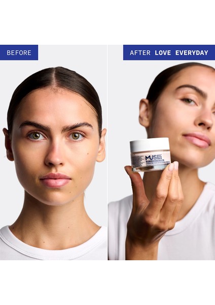 Love Everyday Cilt Tonu Aydınlatıcı & Eşitleyici | Nemlendirici Krem | Spf 15