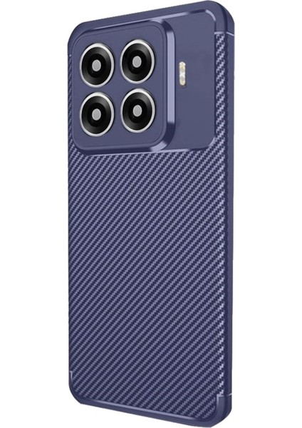 Xiaomi 15T Pro Kılıf Negro Karbon Desen Silikon + Ekran Koruyucu