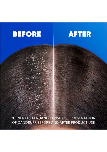 Head And Shoulders Şampuan Hindistan Cevizi 330ML × 6 Adet fiyatları