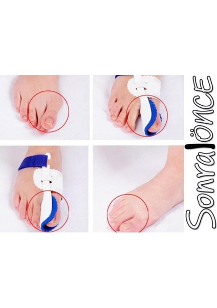 Gece Uyku Parmak Koruyucu fiyatları