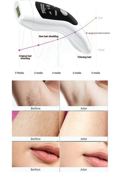 Ipl Tüy Dökücü 5 Modlu Erkek Tıraş Makinesi Kadın Tüy Dökücü Epilatörü 990.000 Flaş Tüy Dökücü Ab Fişi (Yurt Dışından) modelleri