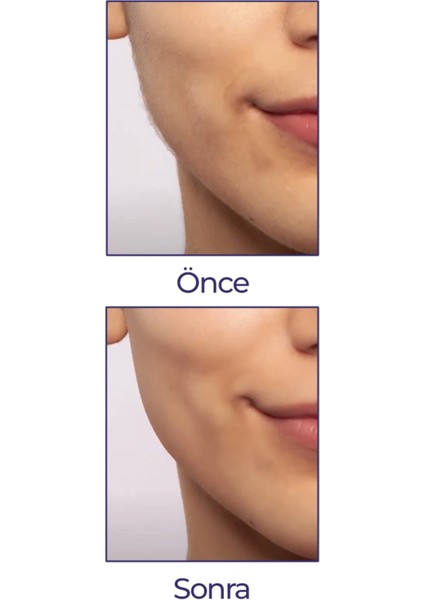 Buğz Flawless Yüz Tüy Temizleyici Şarjlı Epilasyon Aleti