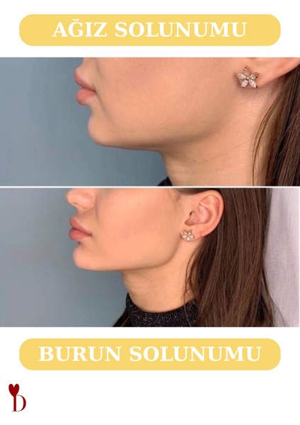 Ağız Bandı 30 Adet, Horlama Önleyici, Nefes Alan Uyku Bandı fırsatları