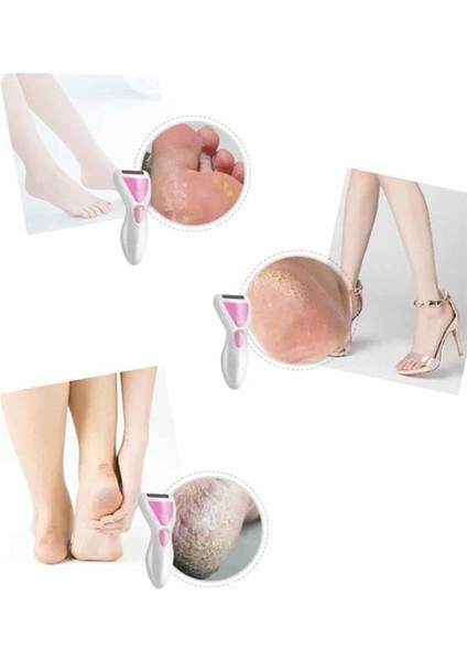 Epilatör Cihazı Epilasyon Aleti Çoklu Başlık Seçeneği Ayak Törpüsü - T751G575-Z77751