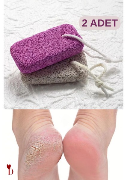 Izla 2 Adettopuk Taşı /ocean Ponza Taşı (H-Mt)