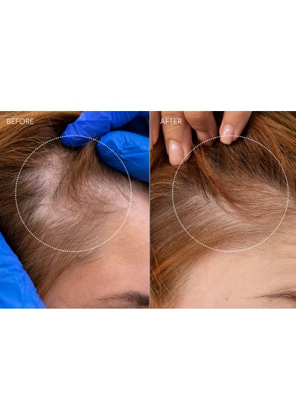 Faq™ 302 Lazer & LED Saç Derisi Masaj Aleti indirimleri