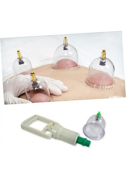 Vakumlu Hortumlu Kuppa Çekme Seti 14 Parça + Hacamat Kuppası 3 Numara 10 Adet 2li Set GY47K9 fiyatları