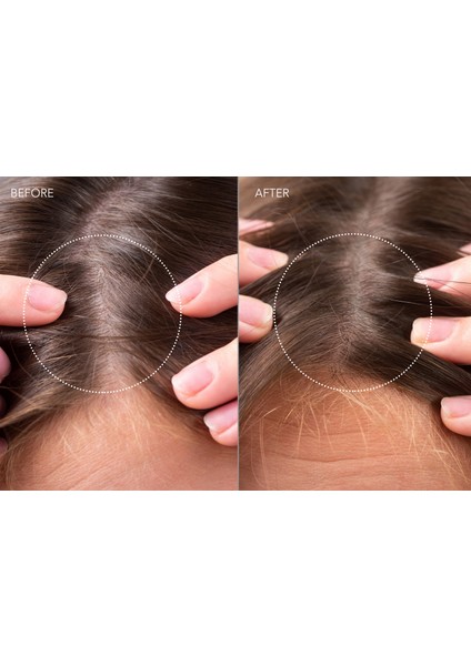 Faq™ 301 LED Saç Güçlendirici Saç Derisi Masaj Aleti indirimleri