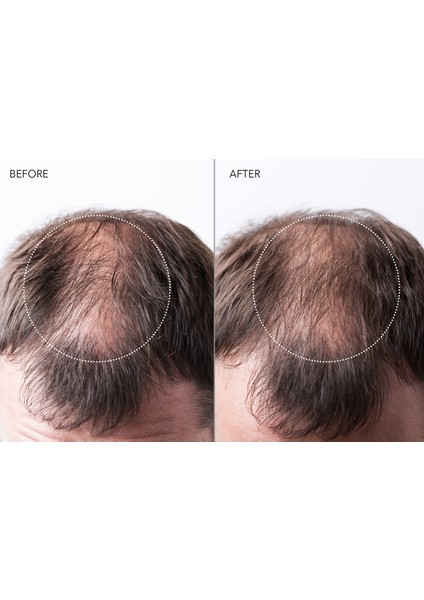 Faq™ 301 LED Saç Güçlendirici Saç Derisi Masaj Aleti