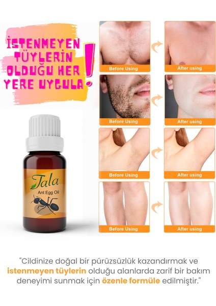 Karınca Yumurtası Yağı Tüy Azaltıcı Tüy İnceltici Tüy Dökücü 20 Ml indirimleri