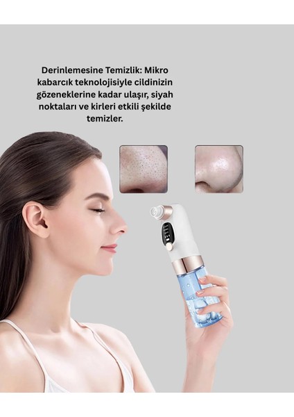 Çok Fonksiyonlu Cilt Bakım Cihazı – Siyah Nokta, Gözenek ve Akne Temizleyici fiyatları