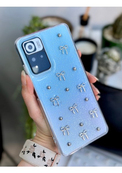 Redmi Note 11 - Note 11S Uyumlu 3D Mini Fiyonk Tasarımlı Oyuncaklı Silikon Kılıf