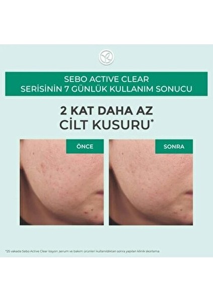 Sebo Pure Vegetal-Salisilik Asit & Sitrik Asit Içerikli Gözenek Sıkılaştırıcı Arındırıcı Tonik 150ML modelleri