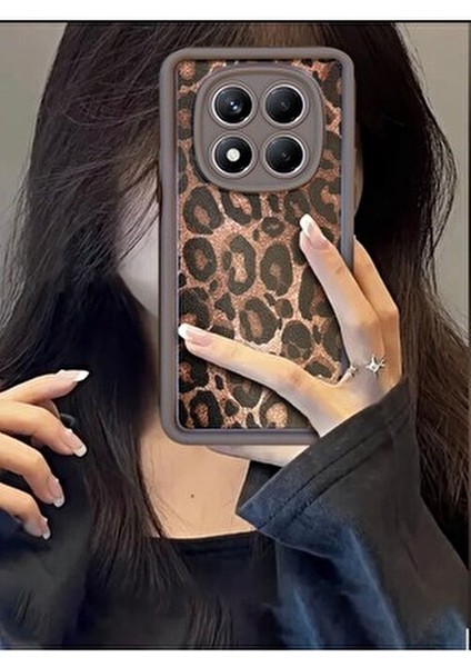 Xiaomi Note 14 Pro 4g Uyumlu – Leopar Desenli, Yumuşak Silikon Kılıf, Darbeye Karşı Dayanıklı Kapak fırsatları