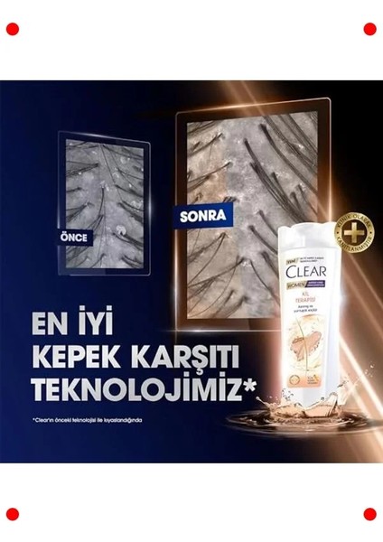 Kil Terapili Kepek Karşıtı ve Yumuşak Saç Şampuanı (350ML) fırsatları