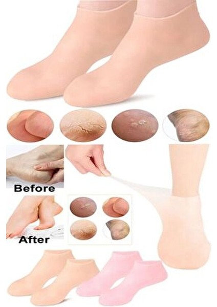 Silikon Nemlendirici Spa Jeli Topuk Çorap Ayak Bakımı Çorap fiyatları