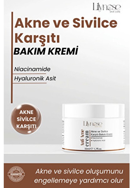 Sivılce Önleyici, Sivılce ve Akne Karşıtı, Leke Gidermeye Yardımcı Bakım Kremi 50ML modelleri