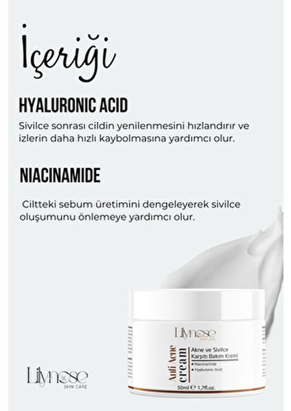 Sivılce Önleyici, Sivılce ve Akne Karşıtı, Leke Gidermeye Yardımcı Bakım Kremi 50ML fırsatları
