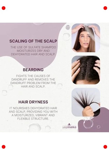 Doğal Kepek Karşıtı Saç Şampuanı indirimleri